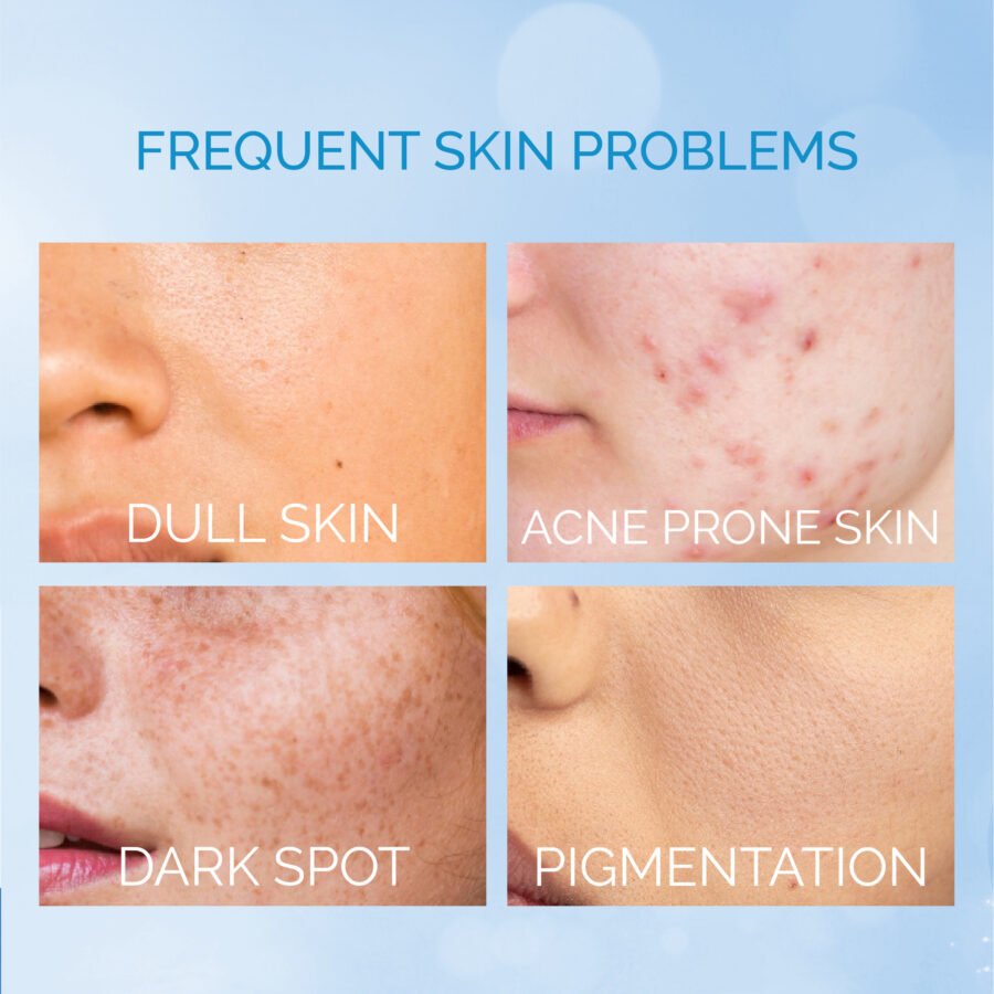 Skin Problems